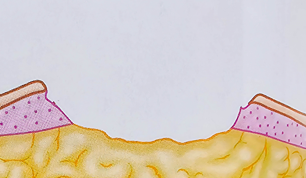 º¯¿¬ÀýÁ¦¼ú À̹ÌÁö